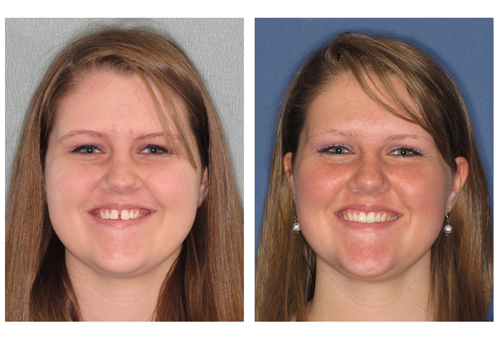Dental Excellence of Brandon