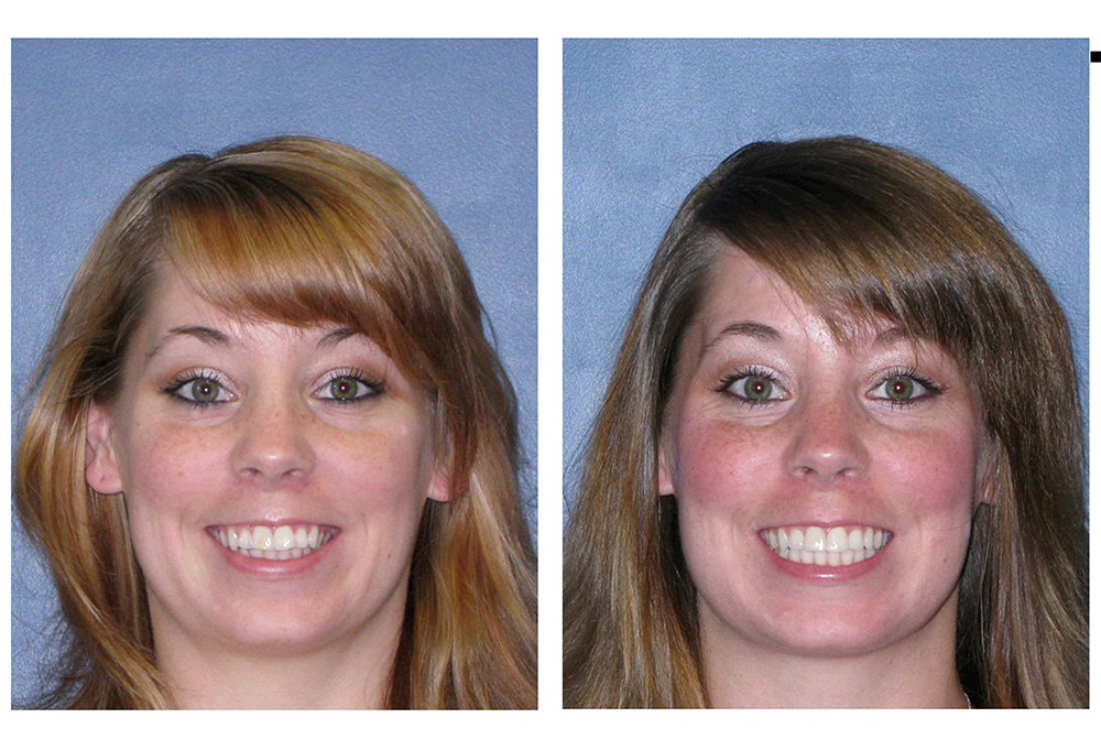 Dental Excellence of Brandon