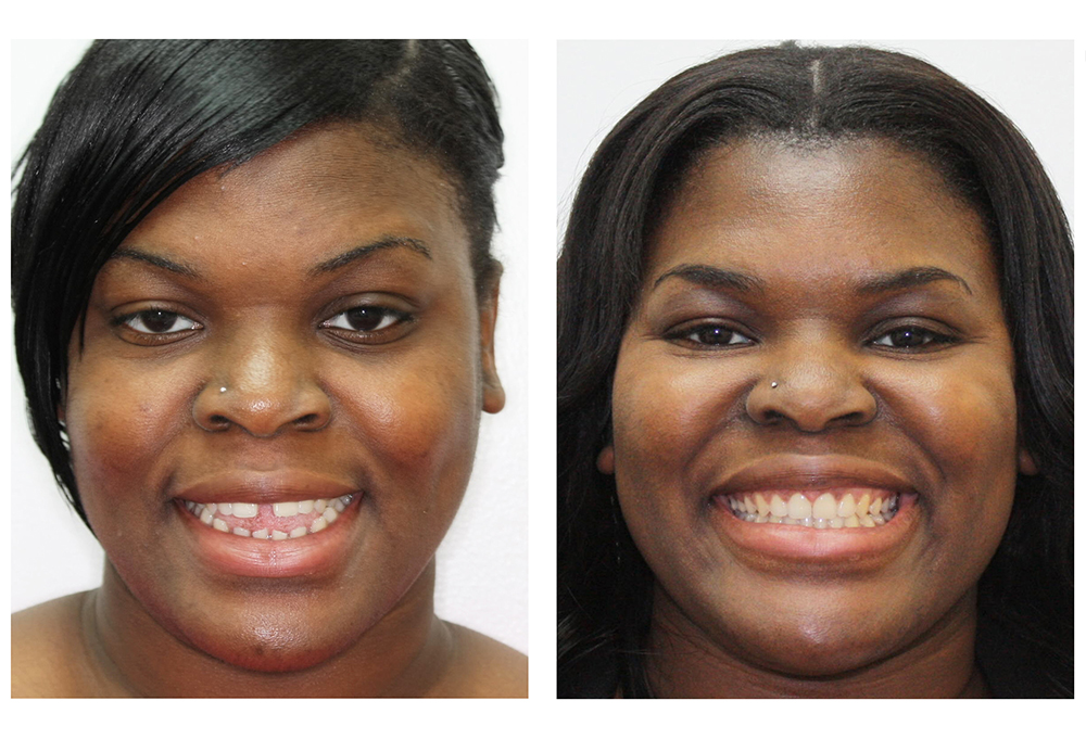 Dental Excellence of Brandon