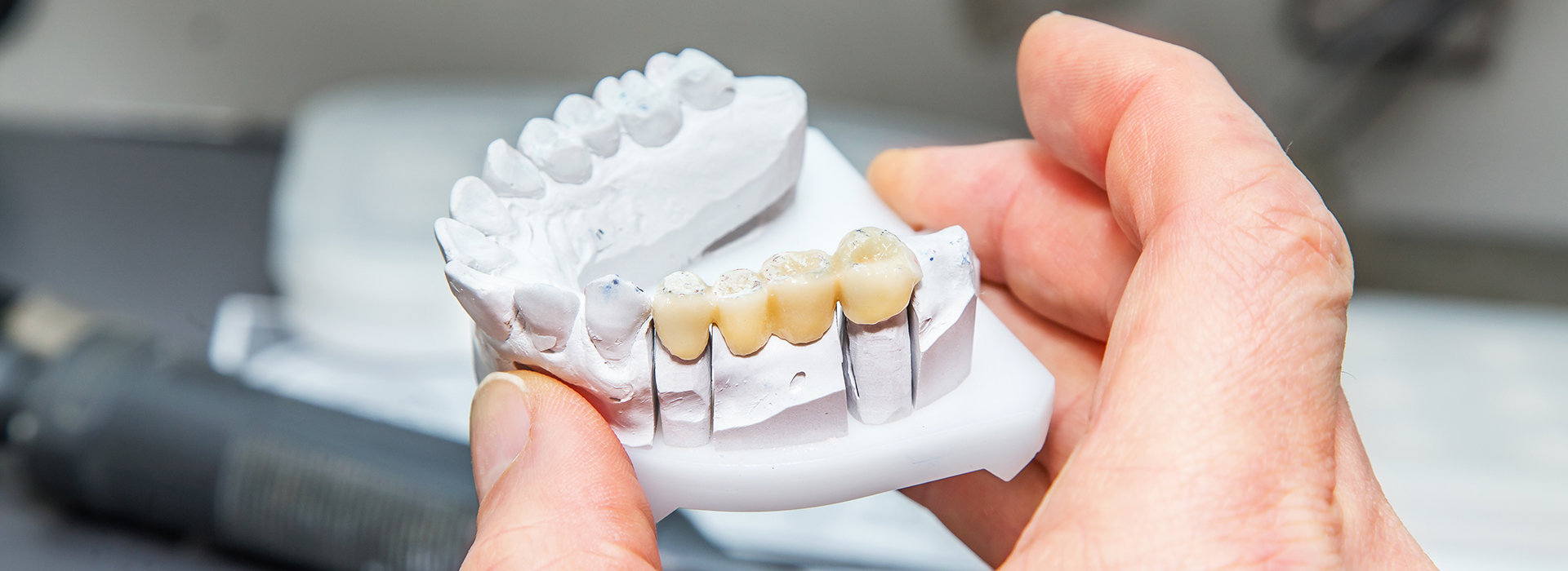 The image shows a person holding a toothbrush with bristles over a tooth model, possibly for demonstration or cleaning purposes.