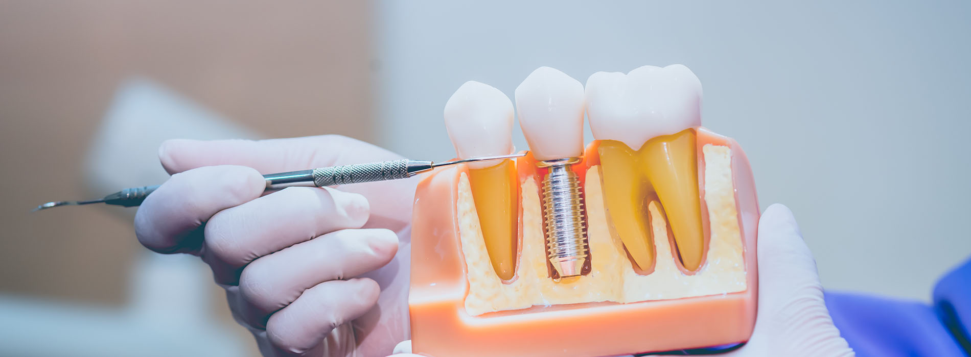 The image shows a close-up view of a dental tool being used on a tooth with a visible cavity, indicating dental work in progress.