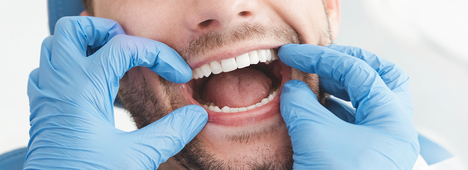 The image shows a man with his mouth wide open, wearing blue gloves, and being attended to by another person who appears to be a dental professional.
